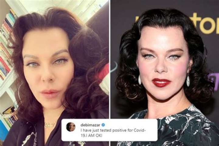 
Debi Mazar Plastic Surgery Includes Facelift Procedures 