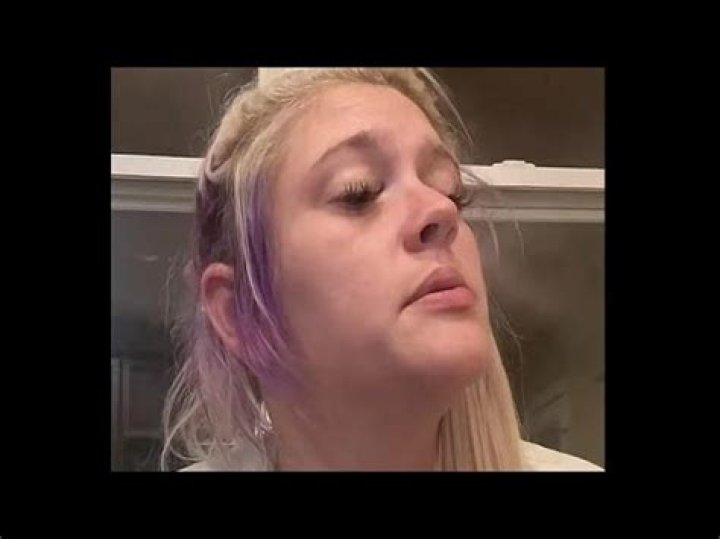 
What Is Wrong With Kylie Strickland Teeth? TikTok Star Domestic Violence Story 